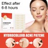 Parche Hidrocoloide Espinillas Imperfecciones F808