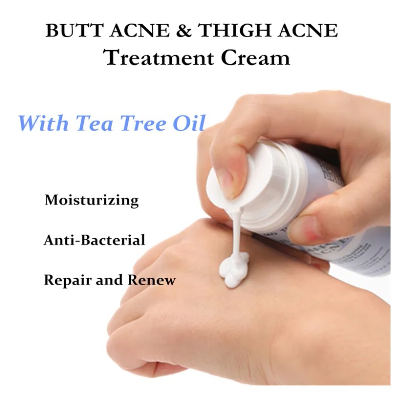Aceite Cremoso De Árbol De Acné Para Glúteos, Elimina El