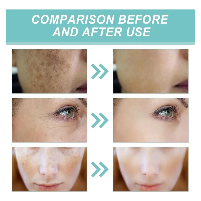 - Corrector De Manchas Oscuras Para Rostro Y Cuerpo Con