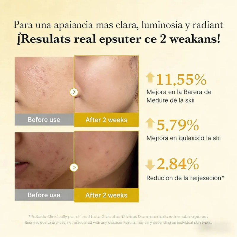 Suero Iluminador Antimanchas Kójico Curcuma Niacinamida 30 M