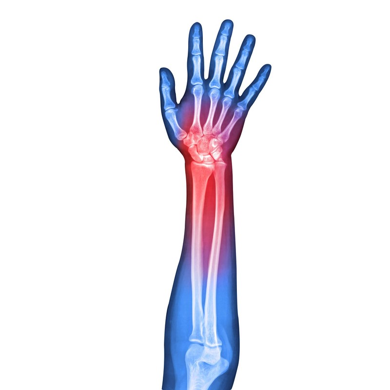 SOLES Handgelenkschiene (SLS523)