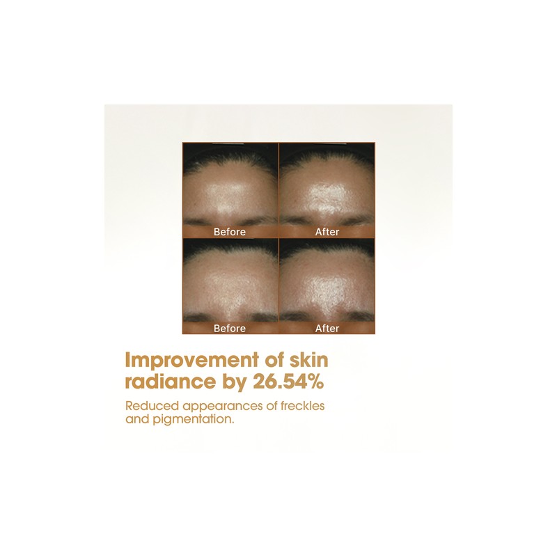 SOME BY MI [SOME BY MI]Galactomyces Serum 30ml