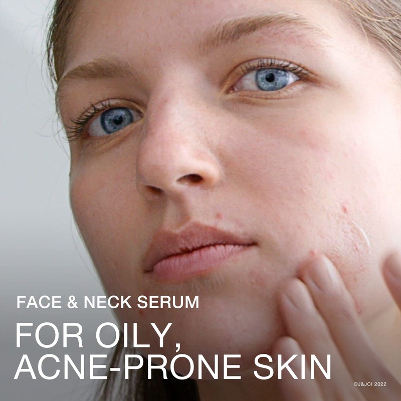 Neutrogena Stubborn Texture Niacinamide Serum 29mL (100062175)