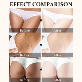 Crema para Aclarar las Axilas y Partes Intimas, Eliminador de Manchas Oscuras para la Cara, Crema Aclaradora para Áreas Íntimas, Cuello, Axilas, Codos, Muslos Internos y Rodillas