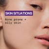 Dry It Out Acne Gel Spot Treatment by Pacifica for
