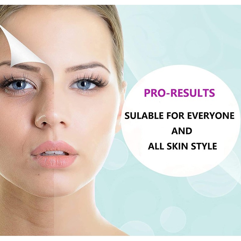 Derma Roller for Face, Body, Hair, Bread - Angel Kiss