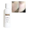 Loción Limpiadora Facial Bellum Mixta Día/noche