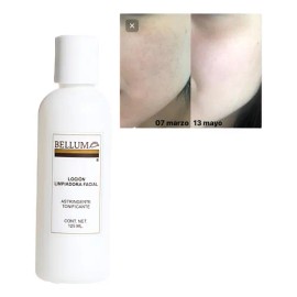 Loción Limpiadora Facial Bellum Mixta Día/noche