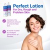 Dermal Therapy Extra Strength Body Lotion – Hydrating Formula with
