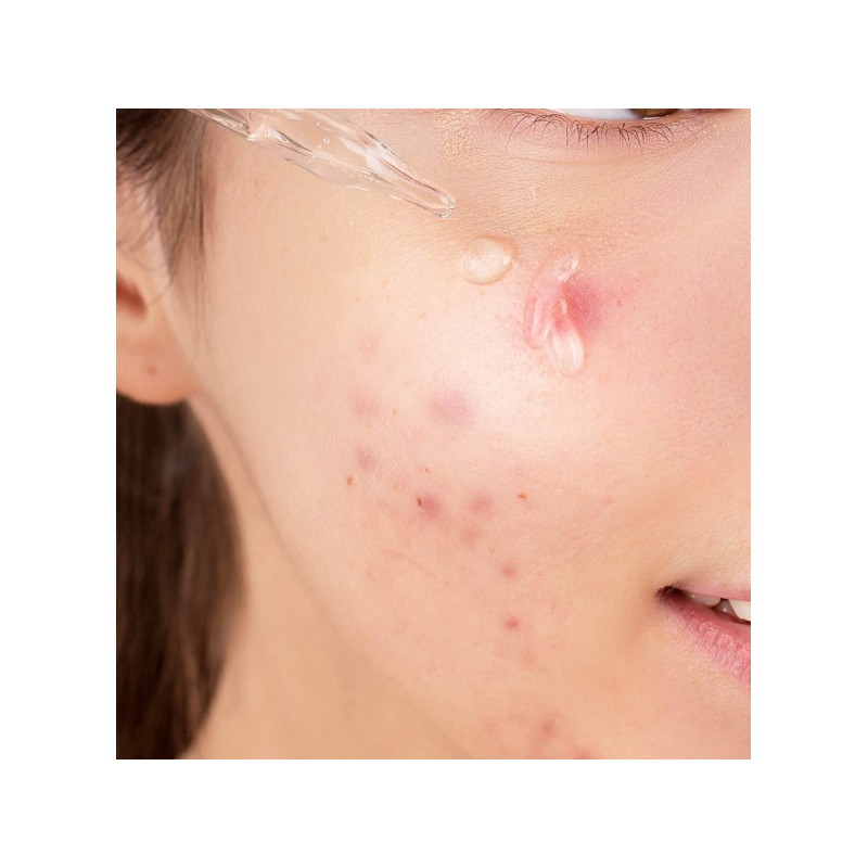 Skin Care/Serum/Vitamin/B/C/Bag/Face/-/Niacinamide/10%/Zinc/1%/K/Beauty
