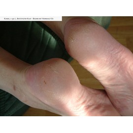 Naturprodukte Schwarz - Callus Ex - Callus Remover and Foot Cream 50 ml