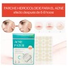 Parches Invisibles Acné Espinillas Facial Absorbente 72pz F