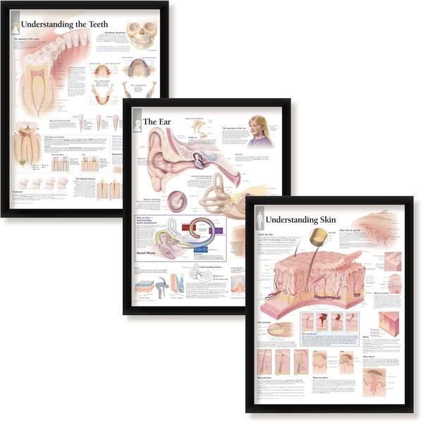 Set of 3 Framed Medical Posters Understanding The Teeth The