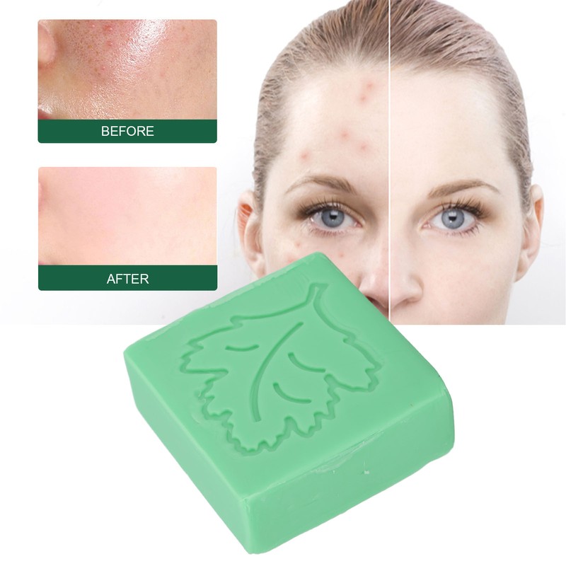 2 Pcs Mite Removal Oil Soap Household Skin Care Acne