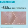 Protector Solar Facial Anti Imperfecciones Superuv Garnier