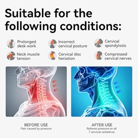 Corrector de postura Owlprince para la alineación del cuello y la columna cervical - Collar ajustable de 360° con 28 niveles, soporte de espuma viscoe