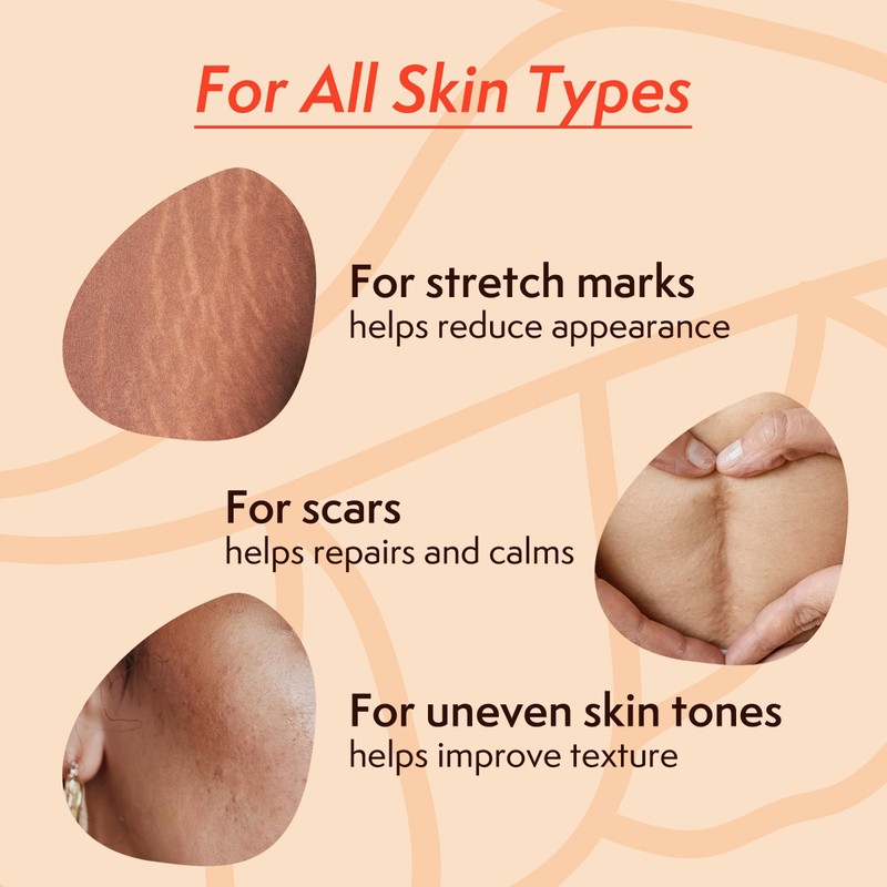 Nature Spell Stretch Mark Body Oil, Strengthens Skin Elasticity &