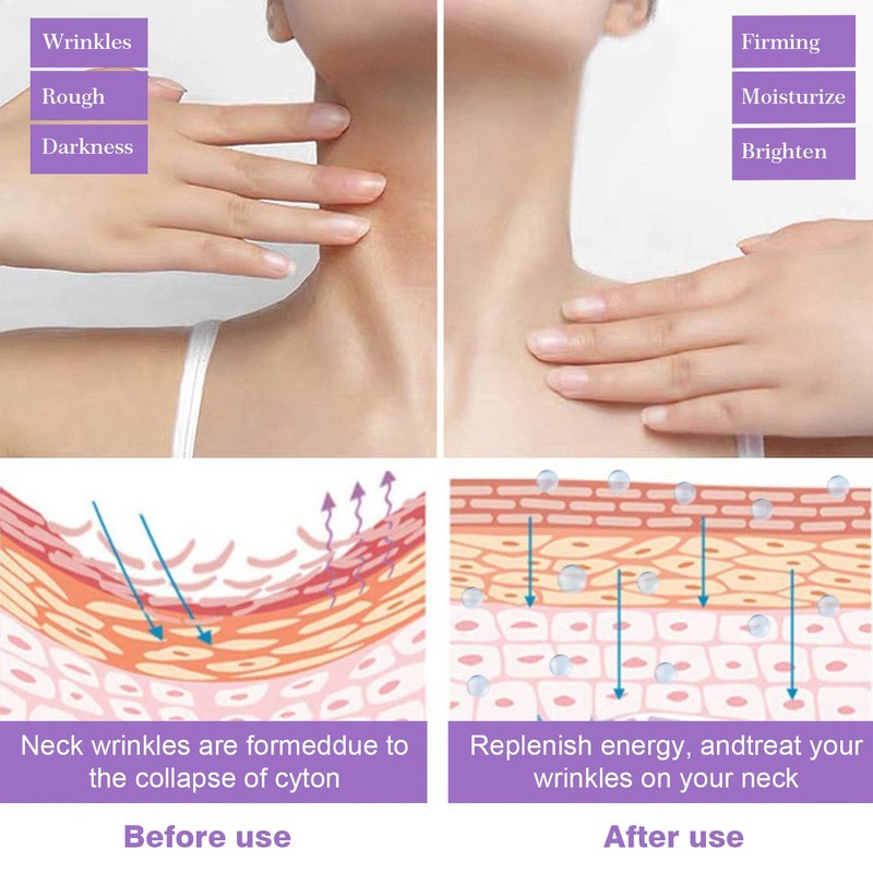 Neck cream, neck cream, neck cream, (B)