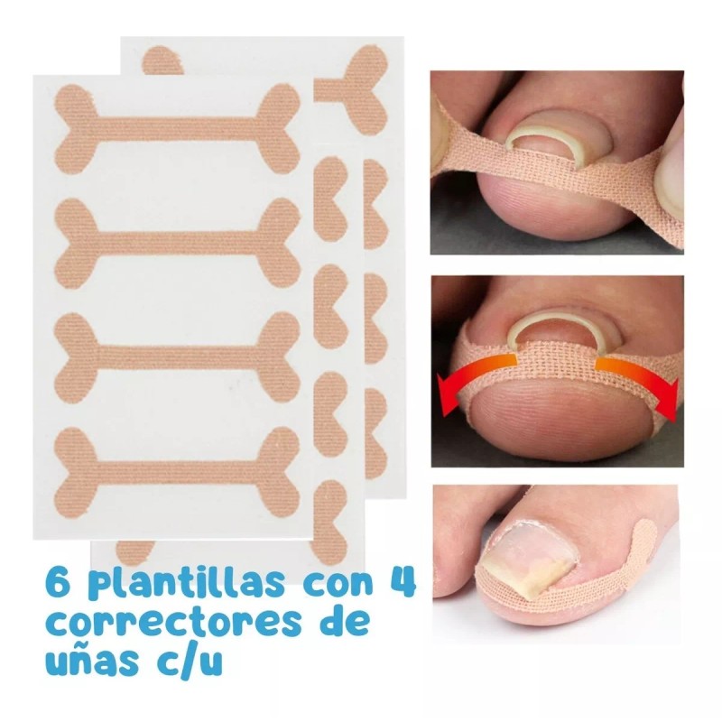 Universo en Linea Kit Corrección Uñas Encarnadas Pie Herramienta Pedicura