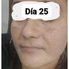 Crema Despigmentante Aclara Piel Acné Manchas Paño Melasma