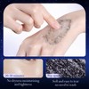 Cleansing mask! Star Rip-Off Mask Adsorbent Blackhead & Acne Exfoliating