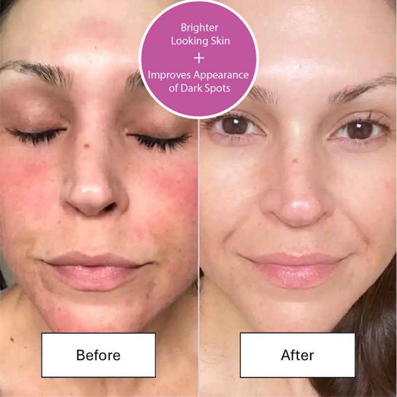 Advanced Bio Complex