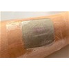 Moderex Hydrocool Hydrogel Dressings for Dry Wounds, Secondary Burns and