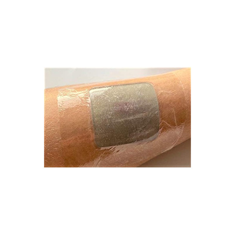 Moderex Hydrocool Hydrogel Dressings for Dry Wounds, Secondary Burns and