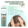 Shampoo Concentrado Ajo Seborrea Resequedad Cabello Graso