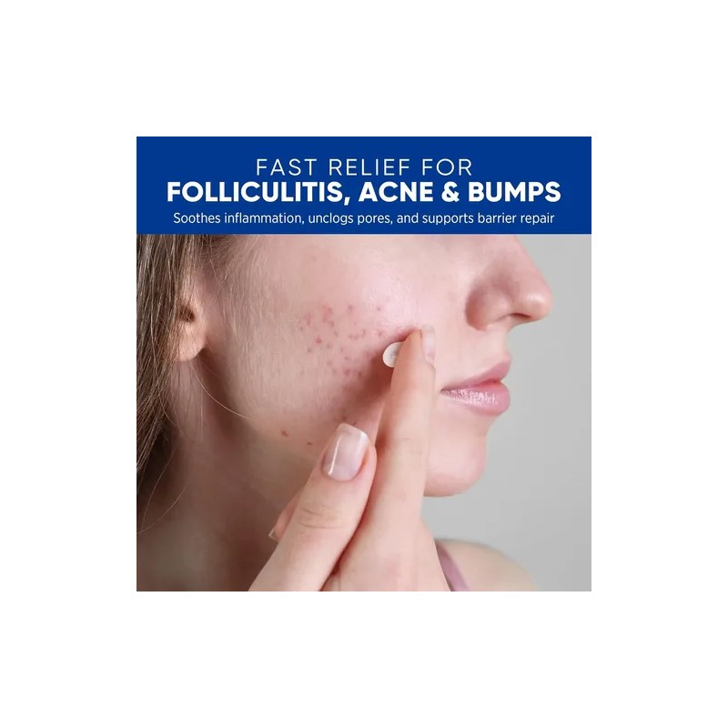 Crema Para El Tratamiento De La Foliculitis Y El Acné