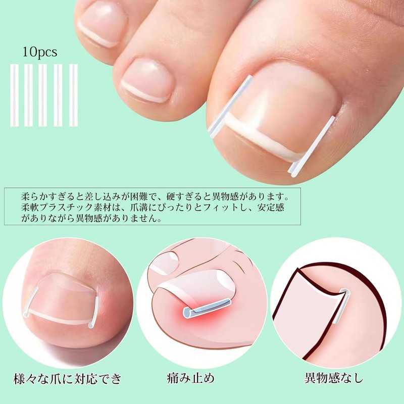 Chisafly Rolling Nail Clips, Rolling Toenails, Foot Coiled Toenails [10