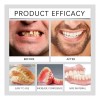 Set Universal Blanqueamiento Dental Shaping Aparatos Den