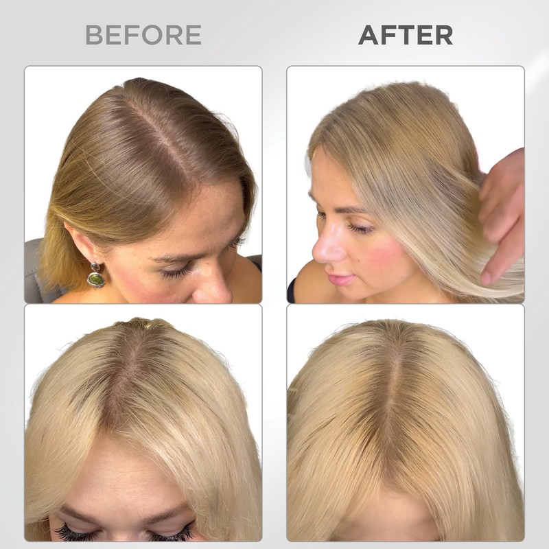 THICK FIBER Root Powder - Hair Concealer for Hair Thickening