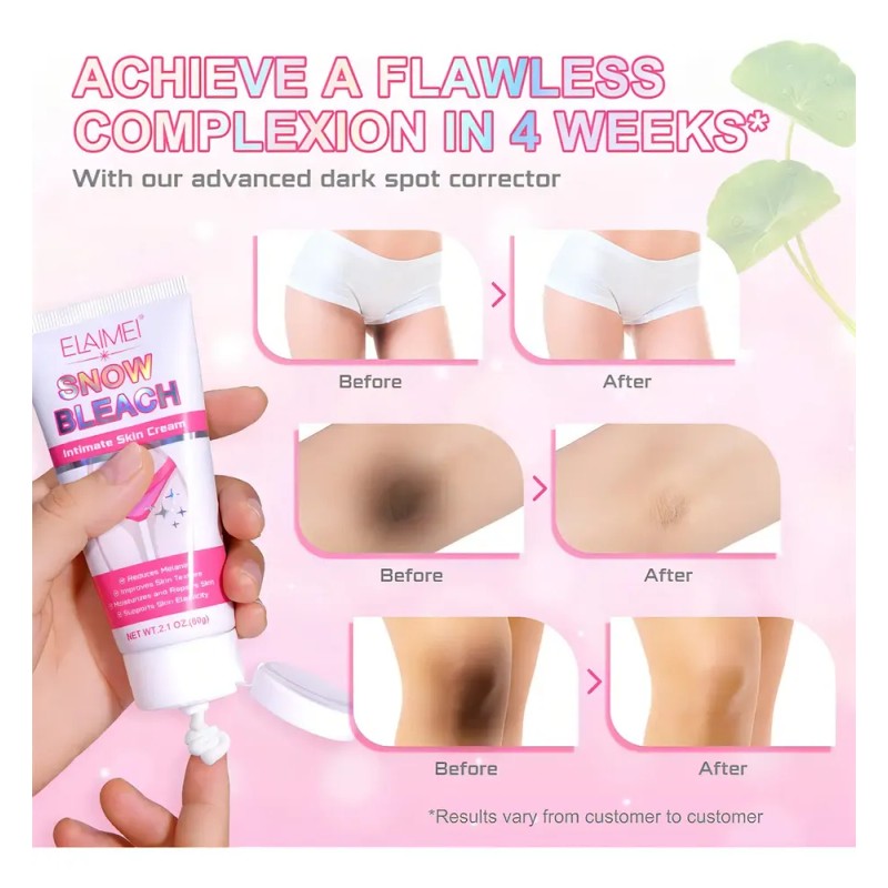 L 2 Cremas Blanqueadoras Cuerpo Zonas Intimas Cuello Z