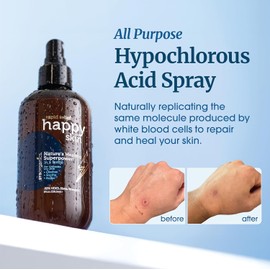 Era Organics Tónico En Spray Happy Skin Con Ácido Hipocloroso Al 0,02%: Extrafuerte, Extrasuave, 100% Natural. Limpiador Facial Y Corporal. Calma, Hidrata Y Repara La Piel Seca Y Sensible. Ph Equili