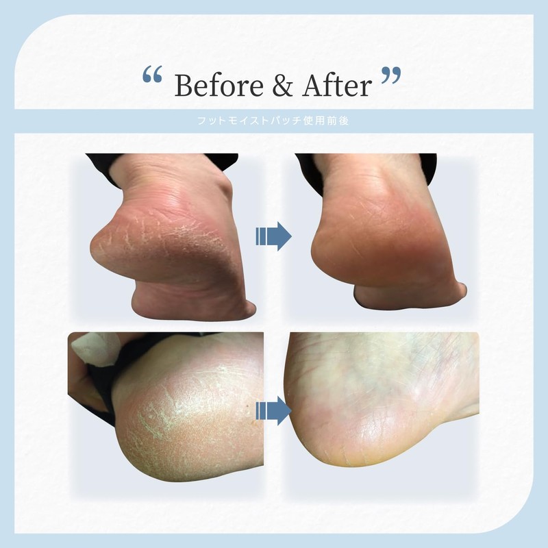 Lab Touch: Night Heel Care, Moisturizing, Patch, Heel Exfoliating, Moisturizing,