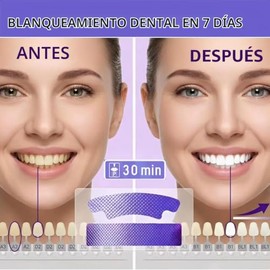 PEENAVY - 28Pcs Tiras Blanqueadoras Dientes,tiras para Blanquear