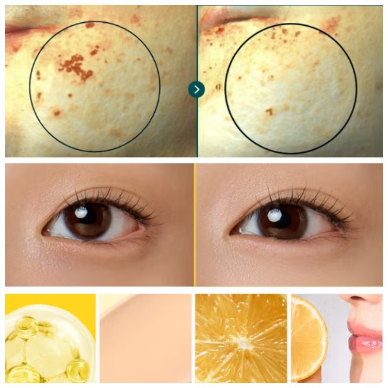 BONCEPT Vita C Conceal Eye Cream 10ml