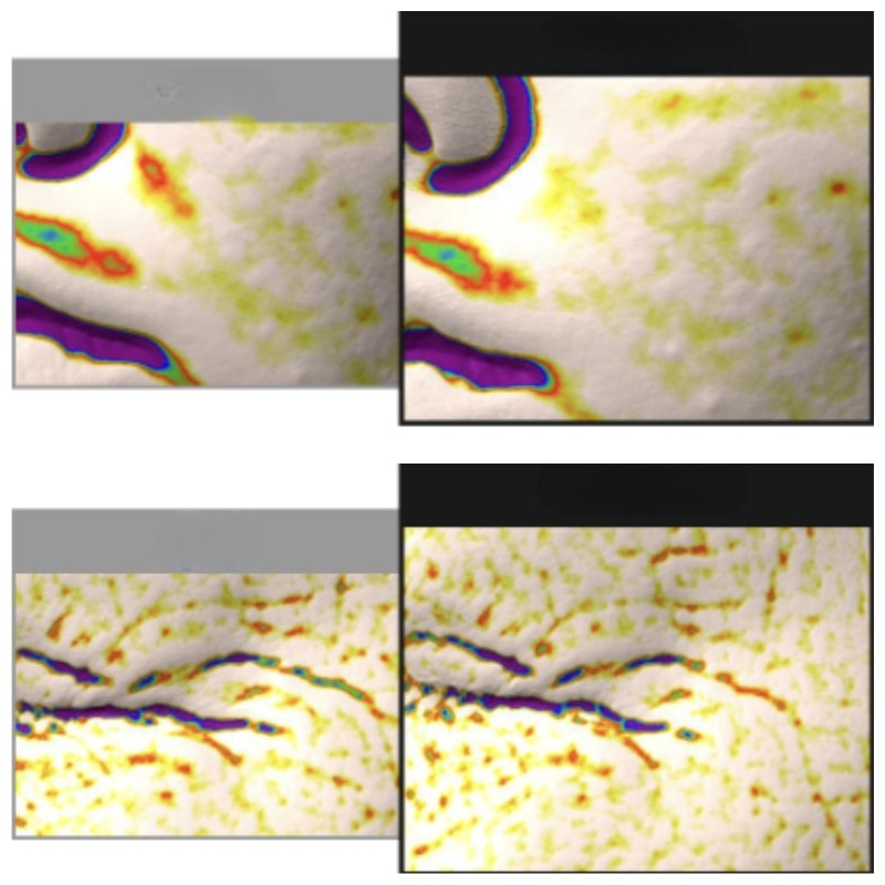 MEDIPEEL PDRN Collagen Wrapping Mask 100ml