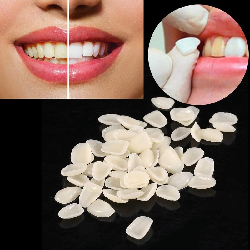 Fyearfly Temporary Tooth Repair, 70 Pieces/Bag Temporary Teeth Crowns Dental