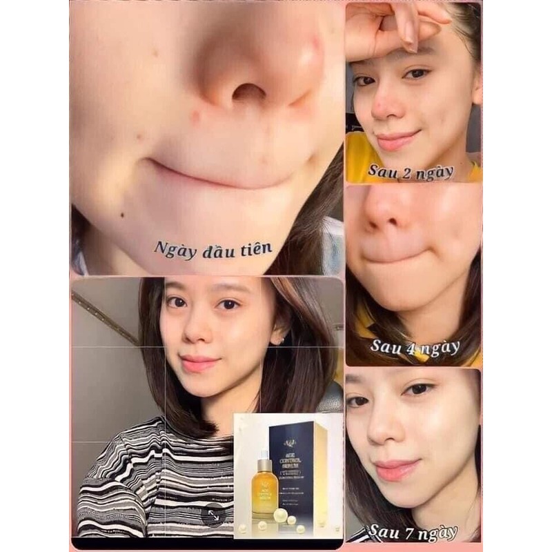 JEEARA- BIDAMEUN AGE CONTROL SERUM 50ML (EXP: 4/2026)