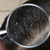 Man 42 Anti-Dandruff Shampoo for Hair with Dandruff and Oily