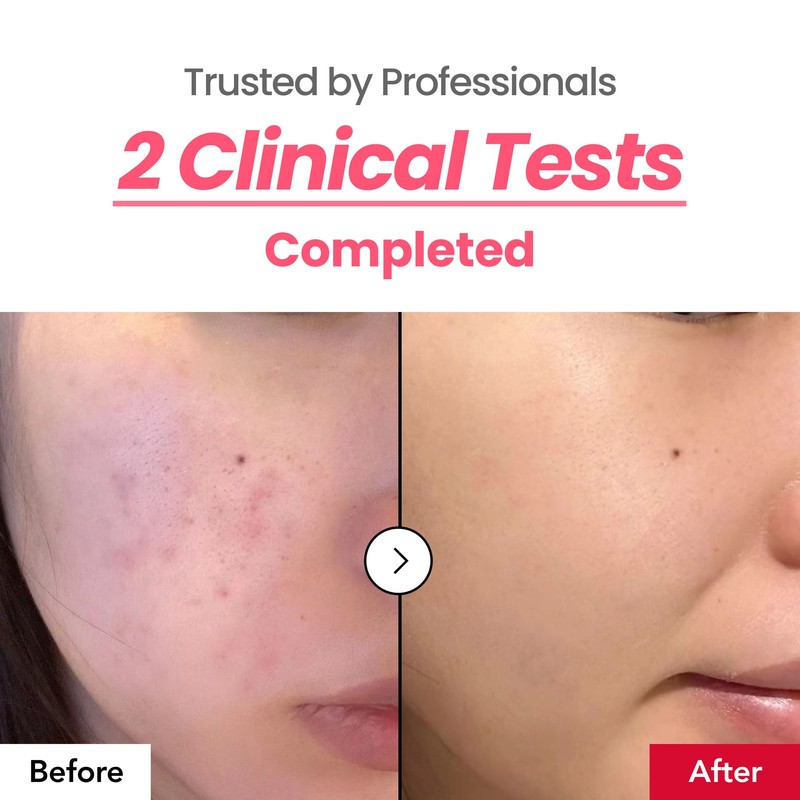 Dr.Percent [Dr.Percent]*TIMEDEAL* Dark Spot 24% Correcting Pink Glow Cream 30ml