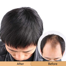 RemeeHi Wig, Men's Short Medical Wig, Human Hair Machine-made, Hand Planted Top/Drawn Parietal, Natural Black, Top Cover, Hidden Gray Hair, Point Wig, Partial Wig, Men's Wig