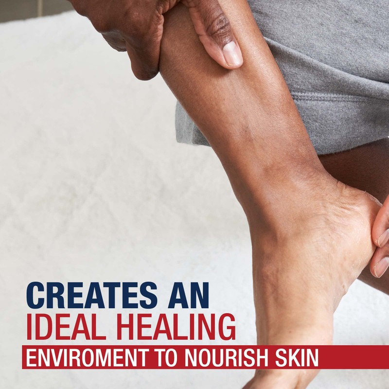Aquaphor Healing Ointment - Moisturizing Skin Protectant for Dry Cracked