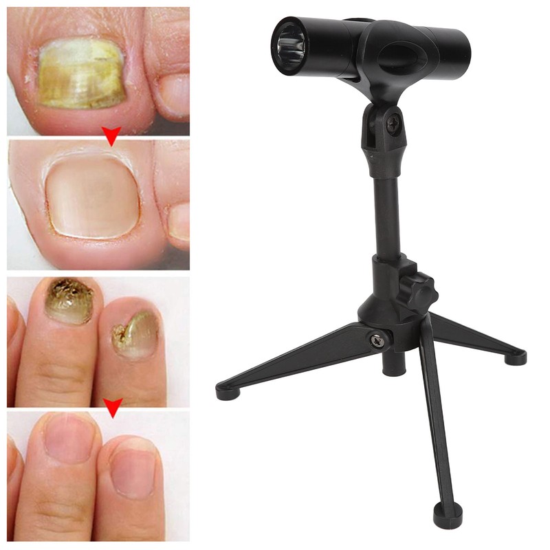 Nail Laser Treatment Pen Portable Pain Free Lightweight Whitening Physical