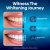 Teeth Whitening Strips – Non-Sensitive Teeth Whitening Stickers, 10 Packs