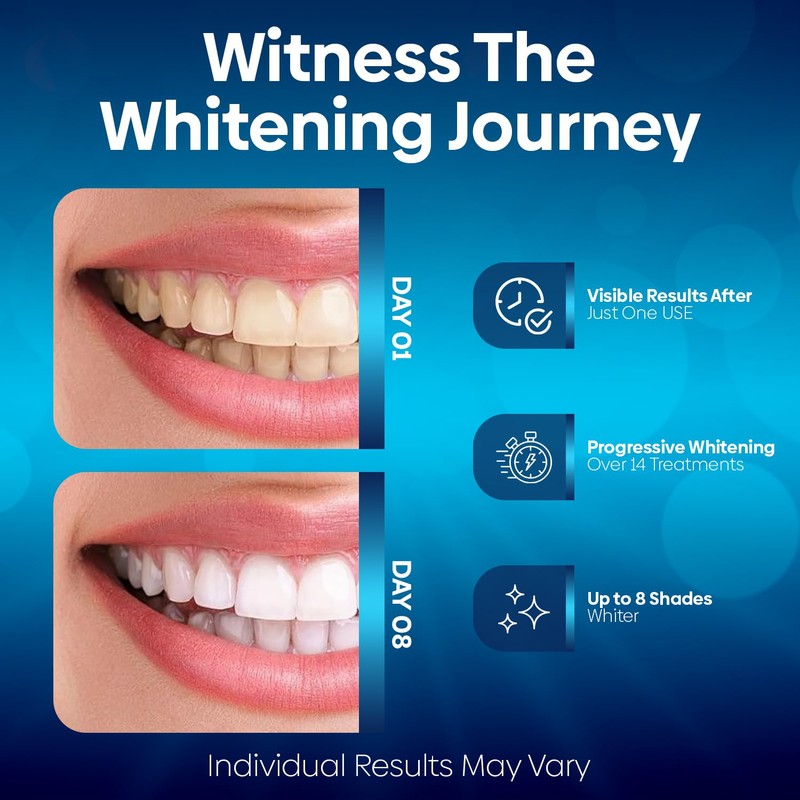 Teeth Whitening Strips – Non-Sensitive Teeth Whitening Stickers, 10 Packs