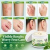 Tea Tree Oil Cream for Fungal-Prone Skin – Suitable for