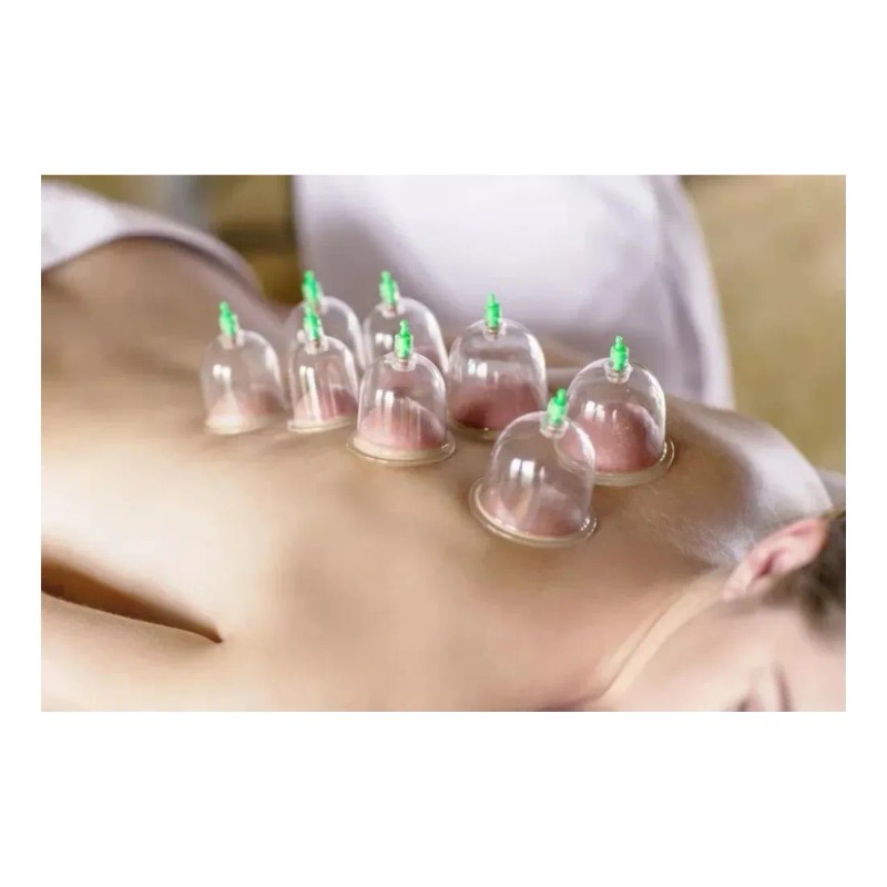 Kit 12 Ventosas Terapeuticas Masaje Succion Adelgazante
